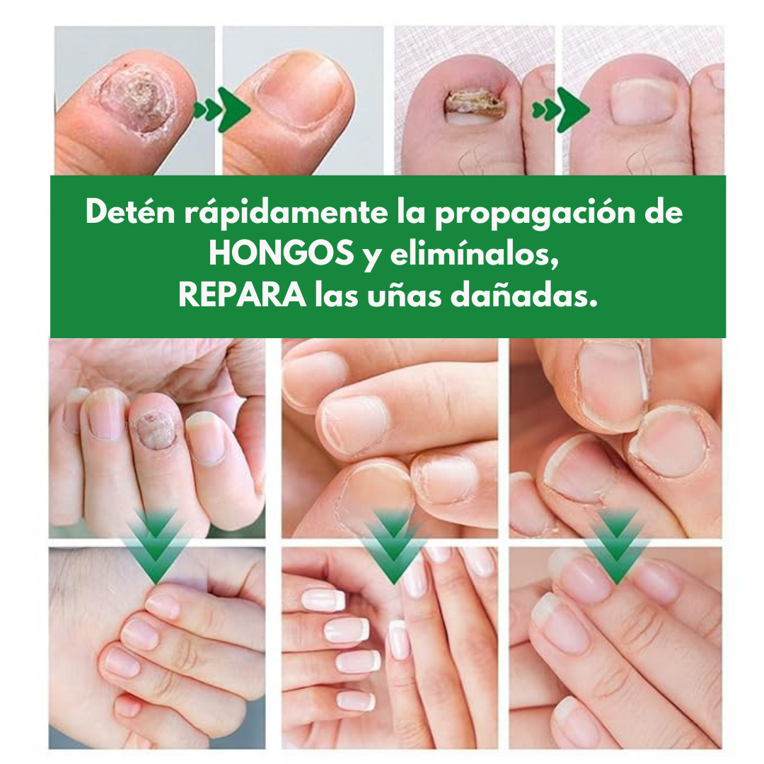 REY DEL JENGIBRE + BEAUTYBOOST 7 DAYS™ PREPARATE PARA VER TU CRECER TUS UÑAS Y CABELLO SIN PARAR